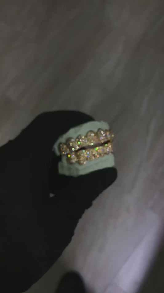 Custom Grillz